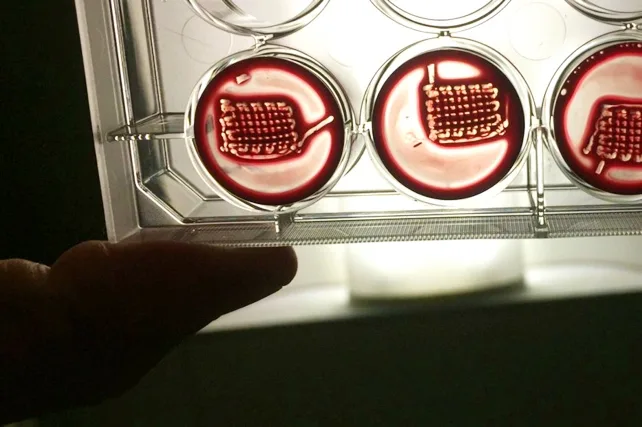 突破性进展有望逆转骨质疏松(图5)