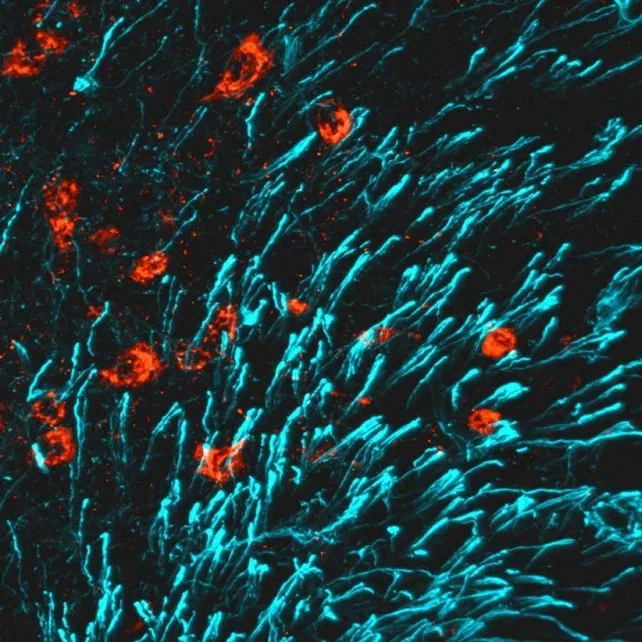 突破性进展有望逆转骨质疏松(图6)