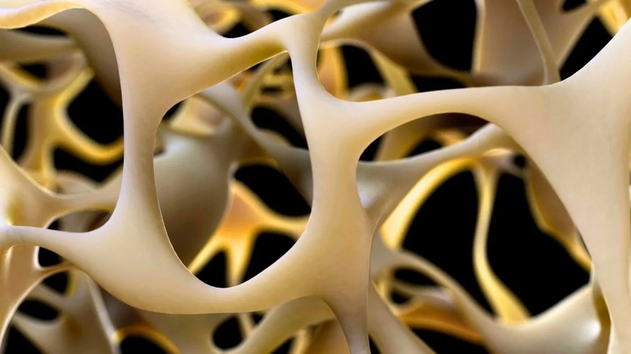 突破性进展有望逆转骨质疏松